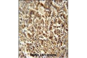 anti-Exosome Complex Exonuclease RRP44 (DIS3) (AA 295-323) antibody
