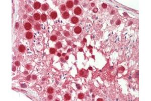 Human Testis: Formalin-Fixed, Paraffin-Embedded (FFPE)