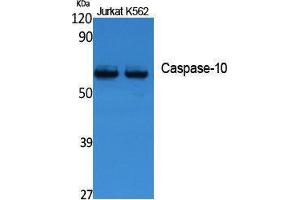 Western Blotting (WB) image for anti-Caspase 10, Apoptosis-Related Cysteine Peptidase (CASP10) (Internal Region) antibody (ABIN3187650) (Caspase 10 anticorps  (Internal Region))