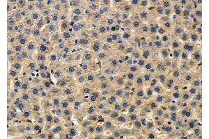 ABIN6257996 and ABIN6275136 at 1/100 staining Rat liver tissue by IHC-P.