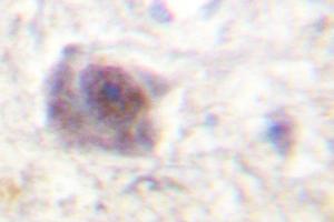 Image no. 1 for anti-Adenomatous Polyposis Coli (APC) antibody (ABIN271993) (APC anticorps)