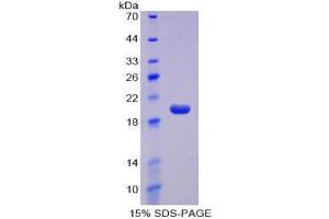SDS-PAGE (SDS) image for CD160 (CD160) (AA 33-171) protein (His tag) (ABIN2124363) (CD160 Protein (CD160) (AA 33-171) (His tag))