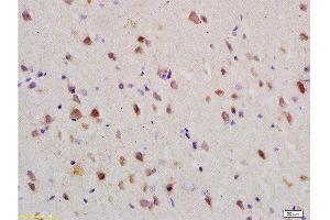 Formalin-fixed and paraffin embedded: rat brain tissue labeled with Anti-Nogo-R Polyclonal Antibody , Unconjugated at 1:200 followed by conjugation to the secondary antibody and DAB staining (RTN4R anticorps  (AA 151-350))