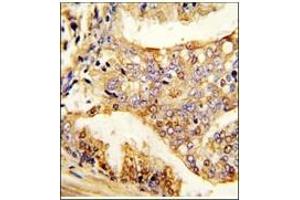 Image no. 1 for anti-Pumilio Homolog 2 (Drosophila) (PUM2) (Ser182) antibody (ABIN360017)