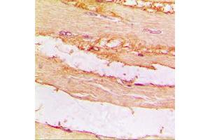 Immunohistochemical analysis of CKMT2 staining in human muscle formalin fixed paraffin embedded tissue section.