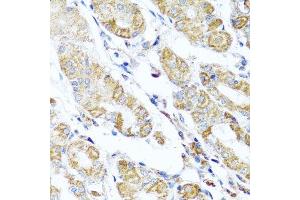 Immunohistochemistry of paraffin-embedded human stomach using DARS2 antibody. (DARS2 anticorps  (AA 406-645))
