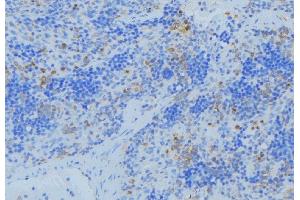 ABIN6273682 at 1/100 staining Human lymph node tissue by IHC-P. (Keratin 36 anticorps  (Internal Region))
