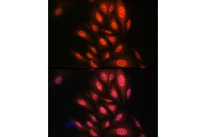 Immunofluorescence analysis of U2OS cells using P antibody (ABIN7269146) at dilution of 1:100. (PAK2 anticorps)