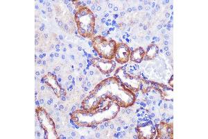 Immunohistochemistry of paraffin-embedded Mouse kidney using PIGM Rabbit pAb (ABIN7269294) at dilution of 1:100 (40x lens).