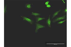 Immunofluorescence of purified MaxPab antibody to CCNT1 on HeLa cell. (Cyclin T1 anticorps  (AA 1-726))