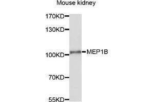 Western blot analysis of extracts of mouse kidney cells, using MEP1B antibody. (Meprin B anticorps)