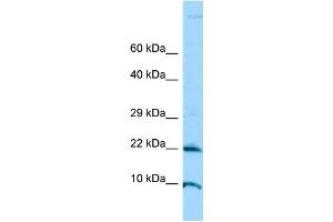 WB Suggested Anti-ADAT2 Antibody Titration: 1. (ADAT2 anticorps  (N-Term))