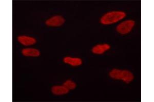 ABIN6267684 staining HT-1080 cells by ICC/IF. (Aurora Kinase B anticorps  (pThr232))