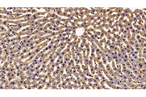 Detection of GHR in Rat Liver Tissue using Polyclonal Antibody to Growth Hormone Receptor (GHR) (Growth Hormone Receptor anticorps  (AA 353-588))