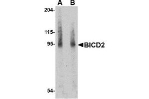 Western Blotting (WB) image for anti-Bicaudal D Homolog 2 (BICD2) (Middle Region) antibody (ABIN1030887) (BICD2 anticorps  (Middle Region))