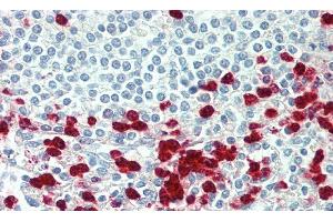 Detection of MMP12 in Human Spleen Tissue using Polyclonal Antibody to Matrix Metalloproteinase 12 (MMP12)