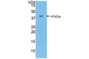 Detection of Recombinant MUC6, Human using Polyclonal Antibody to Mucin 6 (MUC6)