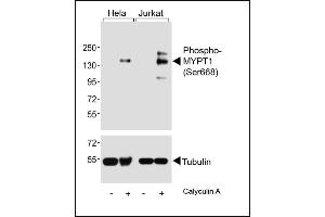 Western blot analysis of lysates from Hela, Jurkat cell line, untreated or treated with Calyculin A, 100nM, using (ABIN6241041 and ABIN6578962) (upper) or Tubulin (lower). (PPP1R12A anticorps  (pSer668))