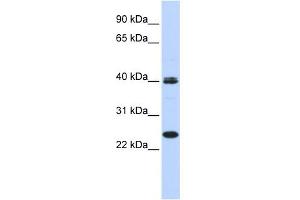 WB Suggested Anti-MESP1 Antibody Titration:  0. (MESP1 anticorps  (N-Term))