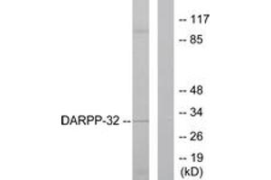 Western blot analysis of extracts from 293 cells, treated with EGF 200ng/ml 30', using DARPP-32 (Ab-75) Antibody. (DARPP32 anticorps  (AA 41-90))