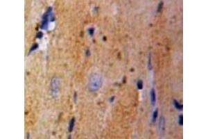IHC-P analysis of heart tissue, with DAB staining. (GLRX3 anticorps  (AA 144-234))