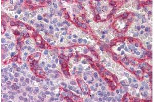 Human, Spleen: Formalin-Fixed, Paraffin-Embedded (FFPE)