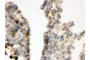 IHC testing of frozen mouse lung tissue with COMT antibody. (COMT anticorps  (AA 52-271))