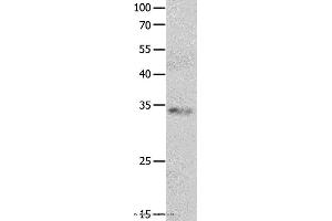 Western blot analysis of Jurkat cell, using RBFOX3 Polyclonal Antibody at dilution of 1:550 (NeuN anticorps)