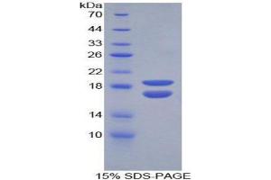 SDS-PAGE (SDS) image for phosphohistidine Phosphatase 1 (PHPT1) (AA 1-124) protein (His tag) (ABIN1080513) (PHPT1 Protein (AA 1-124) (His tag))