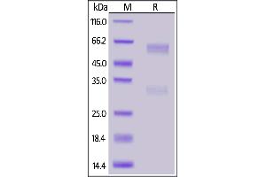 Biotinylated SARS-CoV-2 Nucleocapsid protein, His,Avitag™ on  under reducing (R) condition.