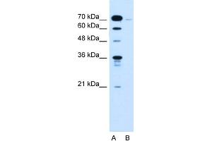 WB Suggested Anti-KLHL31 Antibody Titration:  0.