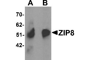 Western Blotting (WB) image for anti-Solute Carrier Family 39 (Zinc Transporter), Member 8 (SLC39A8) (C-Term) antibody (ABIN1030823) (SLC39A8 anticorps  (C-Term))