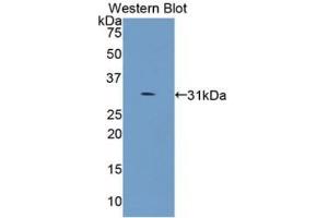 Detection of Recombinant COL4a5, Human using Monoclonal Antibody to Collagen Type IV Alpha 5 (COL4a5) (COL4a5 anticorps  (AA 1461-1685))