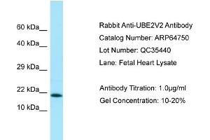 Western Blotting (WB) image for anti-Ubiquitin-Conjugating Enzyme E2 Variant 2 (UBE2V2) (C-Term) antibody (ABIN2774407) (UBE2V2 anticorps  (C-Term))