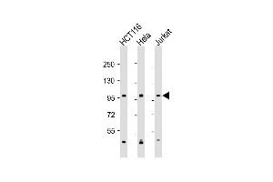 Western Blot at 1:2000 dilution Lane 1: HCT116 whole cell lysate Lane 2: Hela whole cell lysate Lane 3: Jurkat whole cell lysate Lysates/proteins at 20 ug per lane. (MANBA anticorps  (AA 712-745))