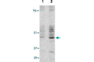 Western blot detection of GST-CD209 fusion protein expressed in E. (DC-SIGN/CD209 anticorps  (Internal Region))