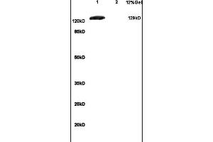Lane 1: mouse brain lysates Lane 2: mouse embryo lysates probed with Anti GRM1 Polyclonal Antibody, Unconjugated (ABIN734663) at 1:200 in 4 °C. (mGluR1 + mGluR5 anticorps  (AA 651-750))