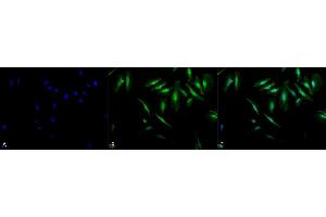 Immunocytochemistry/Immunofluorescence analysis using Rabbit Anti-Alpha B Crystallin Polyclonal Antibody (ABIN361836 and ABIN361837).