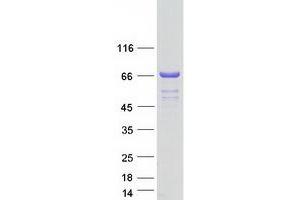 Validation with Western Blot