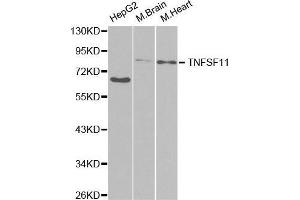 Western blot analysis of extracts of various cell lines, using TNFSF11 antibody. (RANKL anticorps  (AA 78-317))