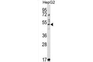 Western Blotting (WB) image for anti-Tripartite Motif Containing 11 (TRIM11) antibody (ABIN2997252) (TRIM11 anticorps)