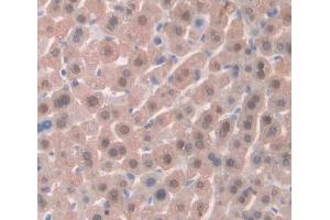 Used in DAB staining on fromalin fixed paraffin- embedded liver tissue