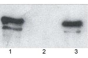 Western blot analysis of wild type p62, GST-tagged (human, recombinant) bound to: (1) glutathione-agarose and (3) ubiquitin-agarose (2: agarose control). (KHDRBS1 anticorps  (AA 387-436))