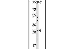 DHRS11 Antibody (Center) (ABIN1537768 and ABIN2849436) western blot analysis in MCF-7 cell line lysates (35 μg/lane). (DHRS11 anticorps  (AA 115-142))