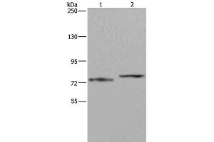Western Blot analysis of Mouse heart tissue and 231 cell using AATF Polyclonal Antibody at dilution of 1:667 (AATF anticorps)