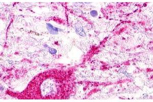 Image no. 1 for anti-MAS1 Oncogene Like Protein (MAS1L) (C-Term) antibody (ABIN1049042) (MAS1L anticorps  (C-Term))