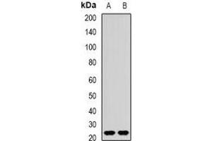 Western blot analysis of REEP1 expression in mouse brain (A), rat brain (B) whole cell lysates. (Receptor Accessory Protein 1 anticorps)
