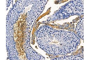 ABIN7094989 and ABIN7099045 at 1/100 staining mouse testis tissue by IHC-P.