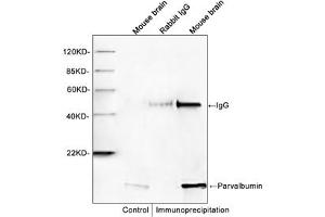 Western blot analysis of immunoprecipitates from mouse brain lysates. (PVALB anticorps)