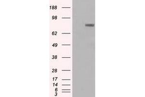 Western Blotting (WB) image for anti-Prominin 2 (PROM2) antibody (ABIN1500435) (Prominin 2 anticorps)